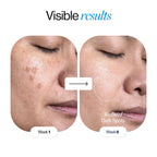 Glutathione Niacinamide Glow Serum (30ml)