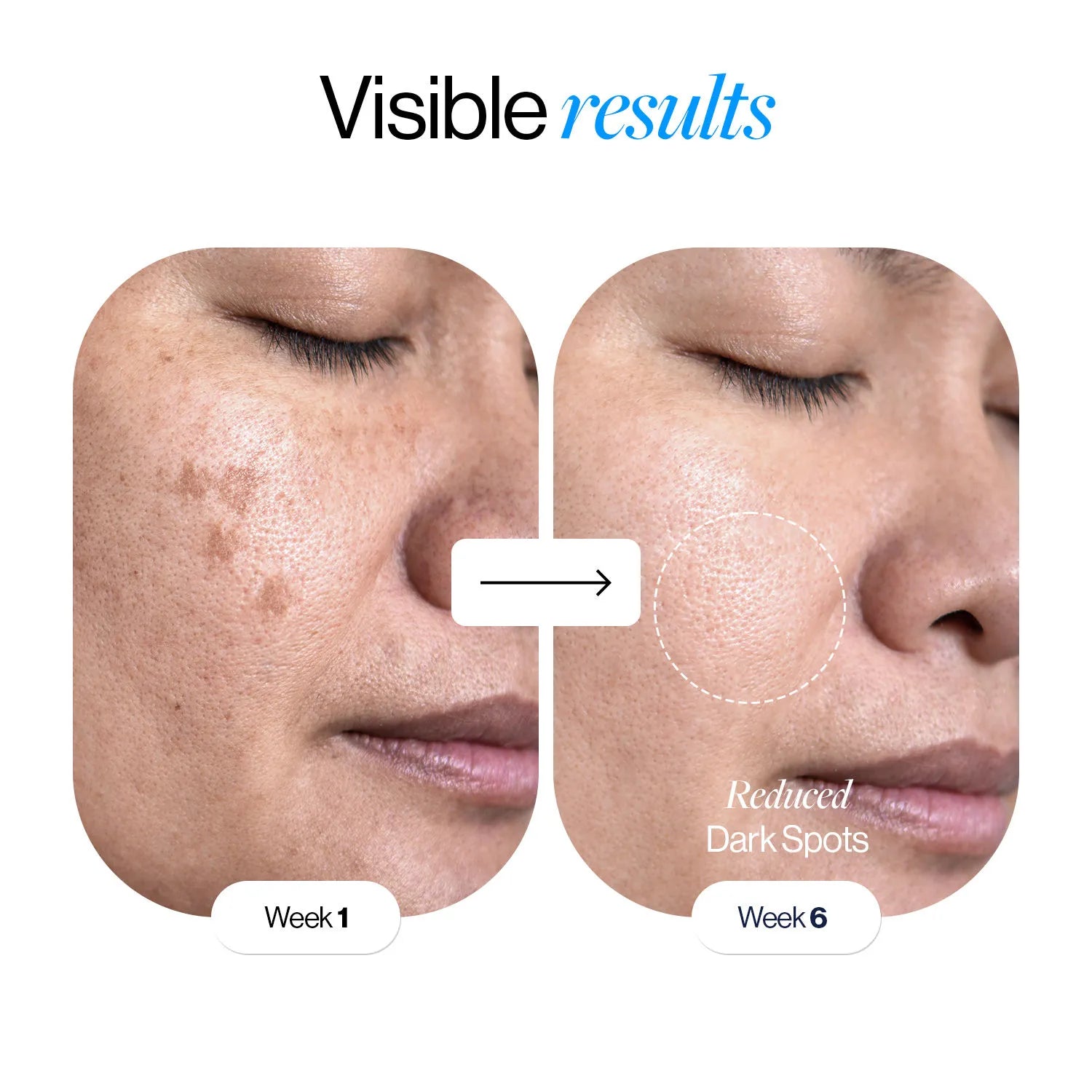 Glutathione Niacinamide Glow Serum (30ml)