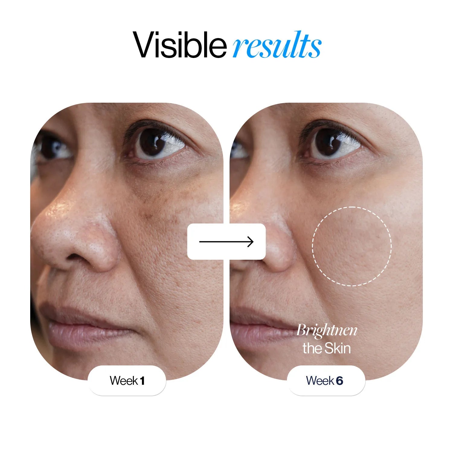 Glutathione Niacinamide Glow Serum (30ml)