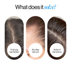 Advanced Hair Growth Serum Roll On (50ml)