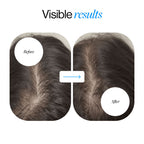 Advanced Hair Growth Serum Roll On (50ml)