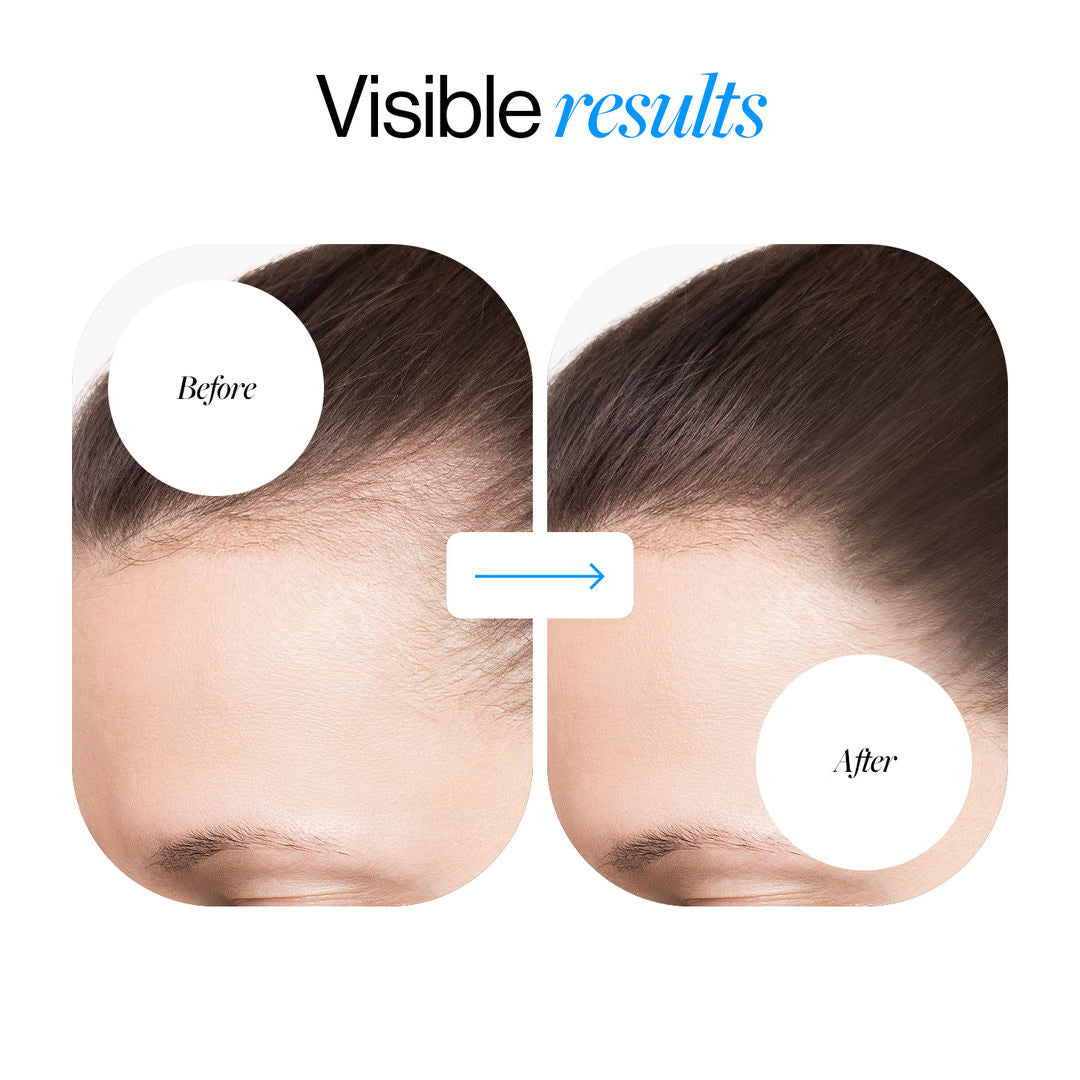 Advanced Hair Growth Serum Roll On (50ml)