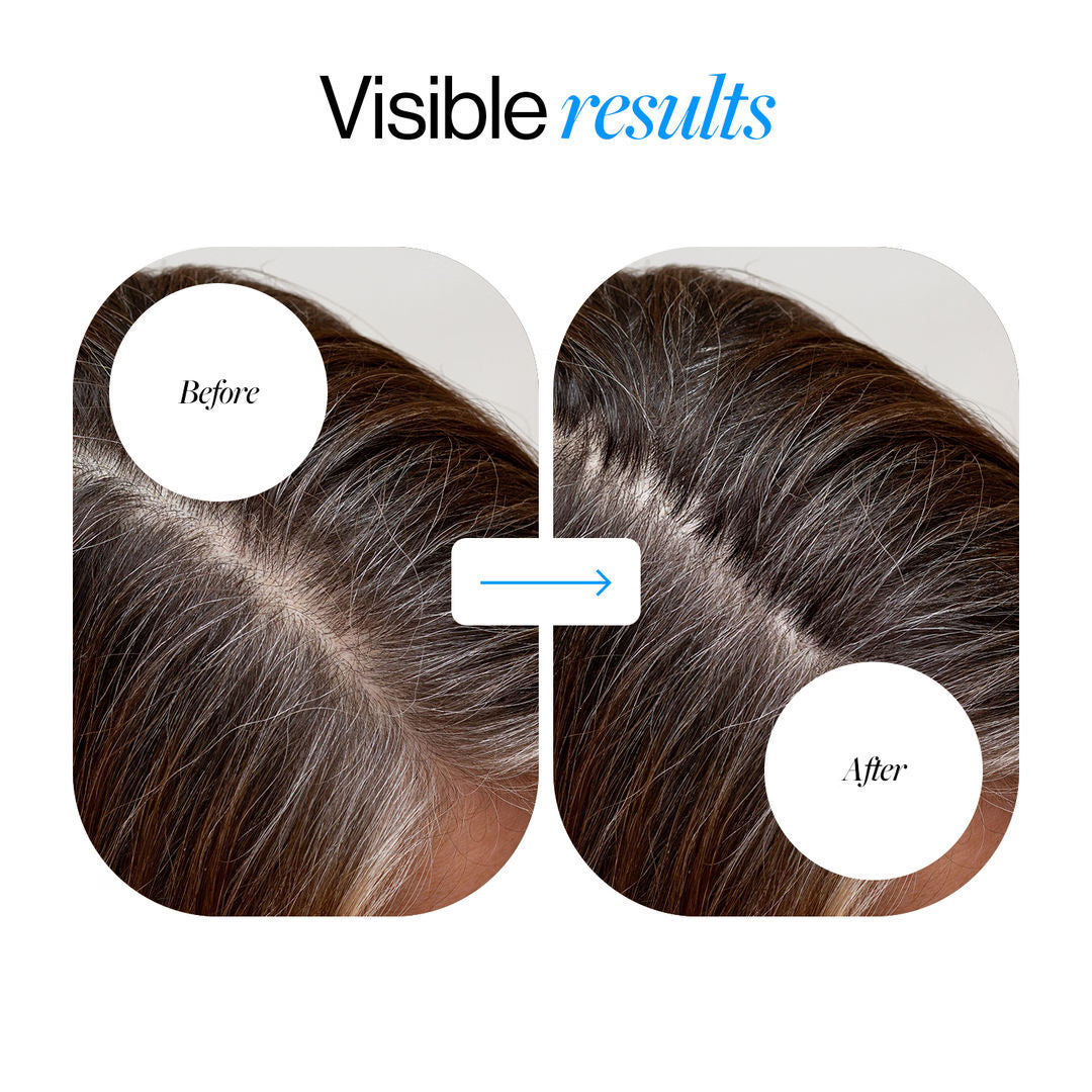 Advanced Hair Growth Serum Roll On (50ml)